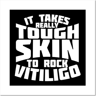 It Takes Really Tough Skin To Rock Vitiligo Posters and Art